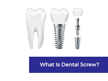 What Is Dental Screw? Explore 7 Advantages and Disadvantages - johoty