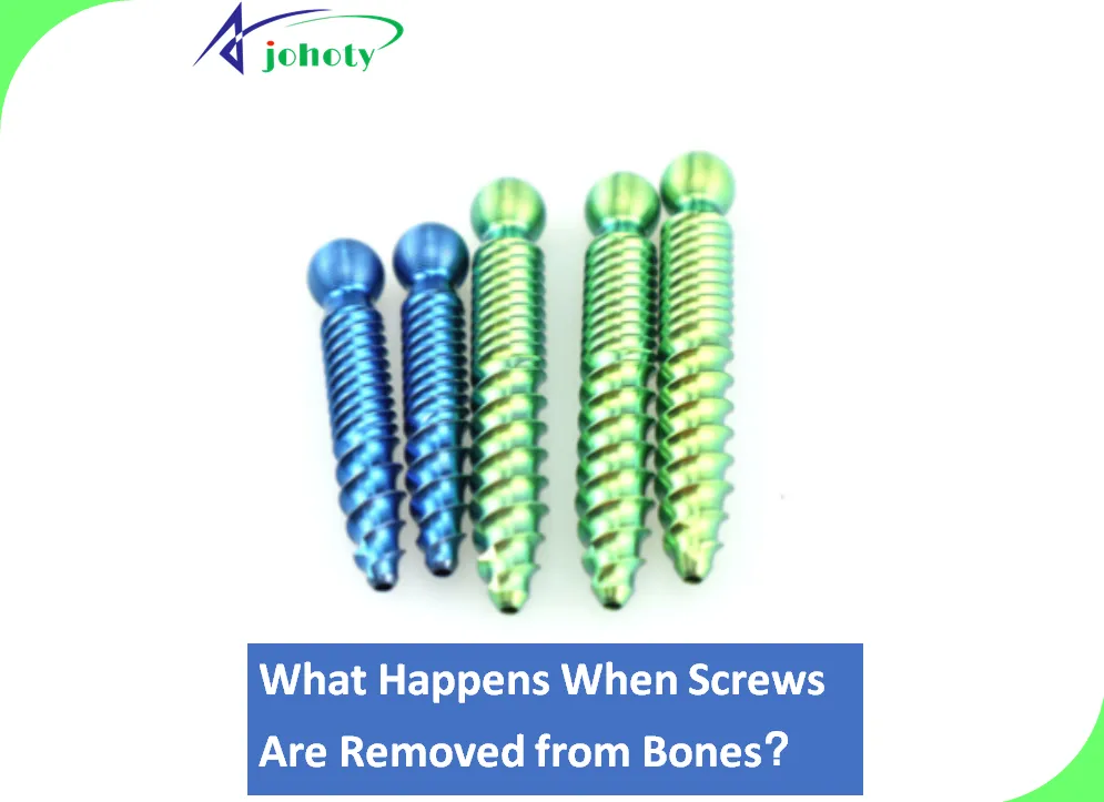 What Happens When Screws Are Removed From Bones_01_bone screws medical screws